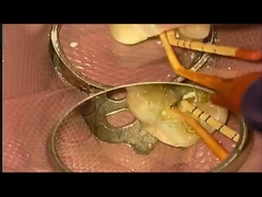 SANI TREATMENT Sprawa